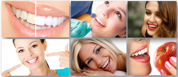 Teeth Whitening 4 You PDF